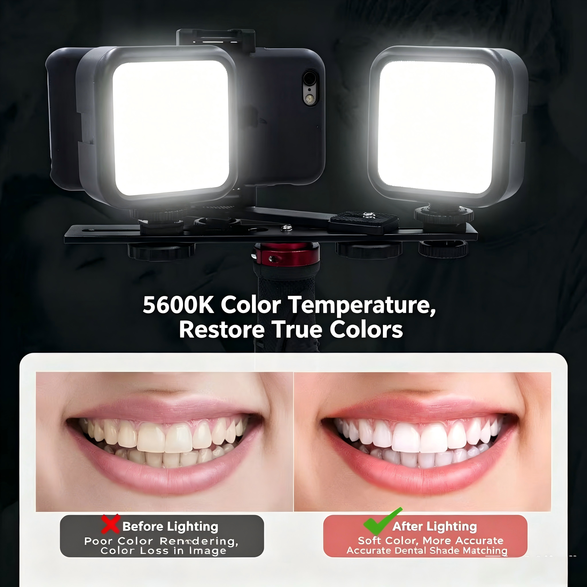 Portable Dental Photography Li - Lighting In Photography Definition avaliação e preço